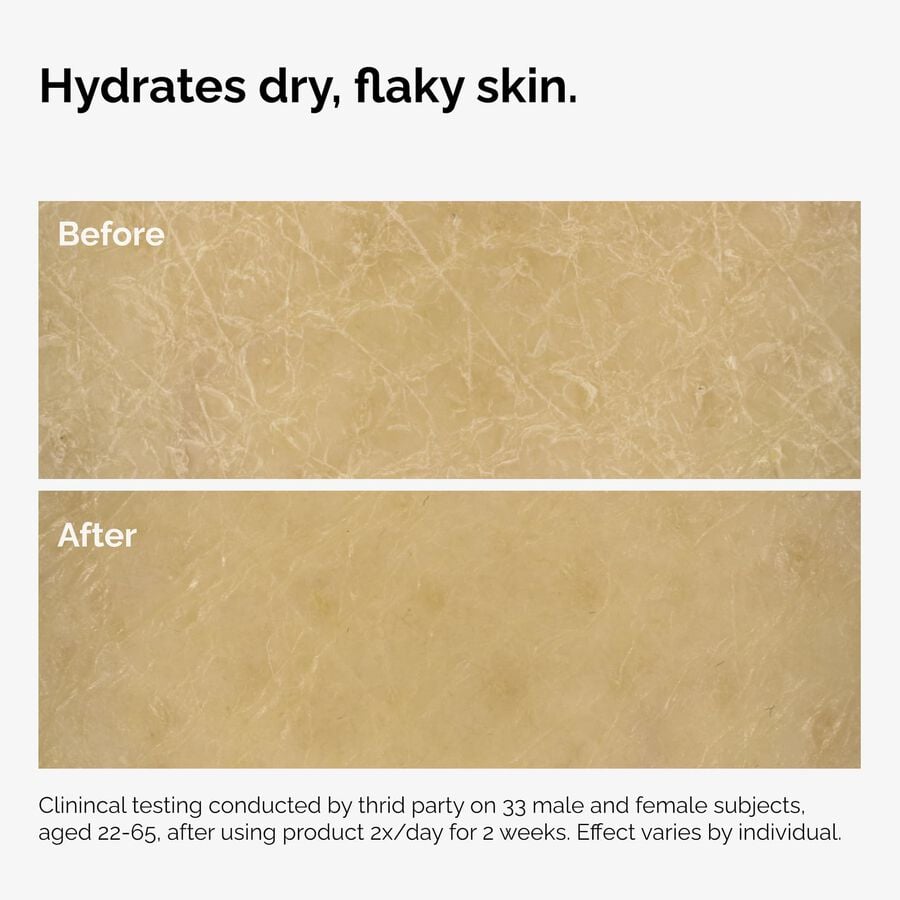 the-body-care-collection-h0 ord-natural-moisturizing-factors-inulin-body-before-after-graphic-02.jpg