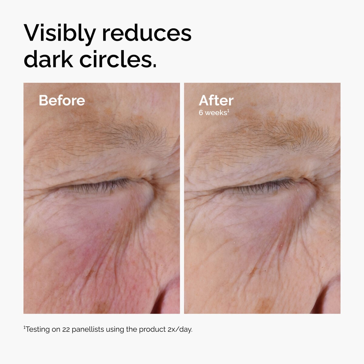 caffeine-solution-5-egcg-eye-serum-i7 ord-caffeine-solution-egcg-dark-circles-before-after.jpg