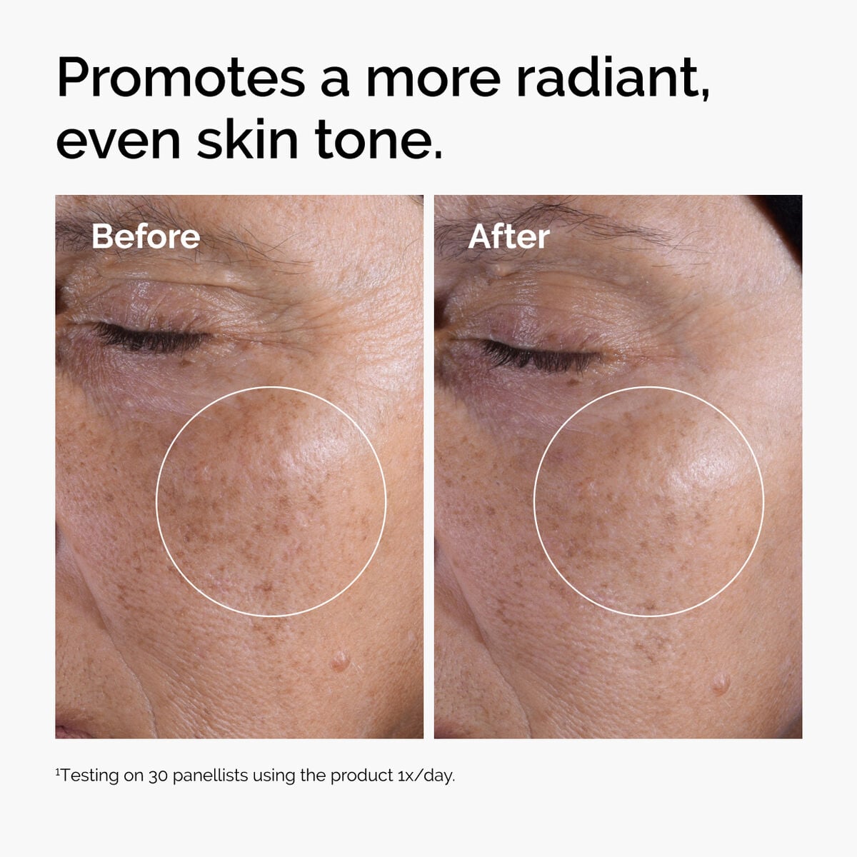 glycolic-acid-7-exfoliating-toner-w1 ord-glycolic-before-after-radiance.jpg