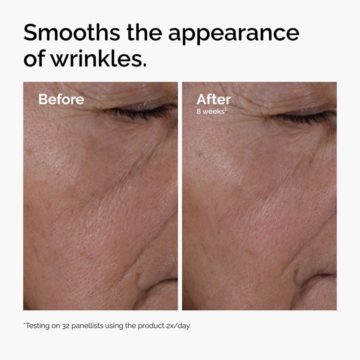multi-peptide-ha-serum-f2 ord-multi-peptide-ha-serum-wrinkles-before-after.jpg