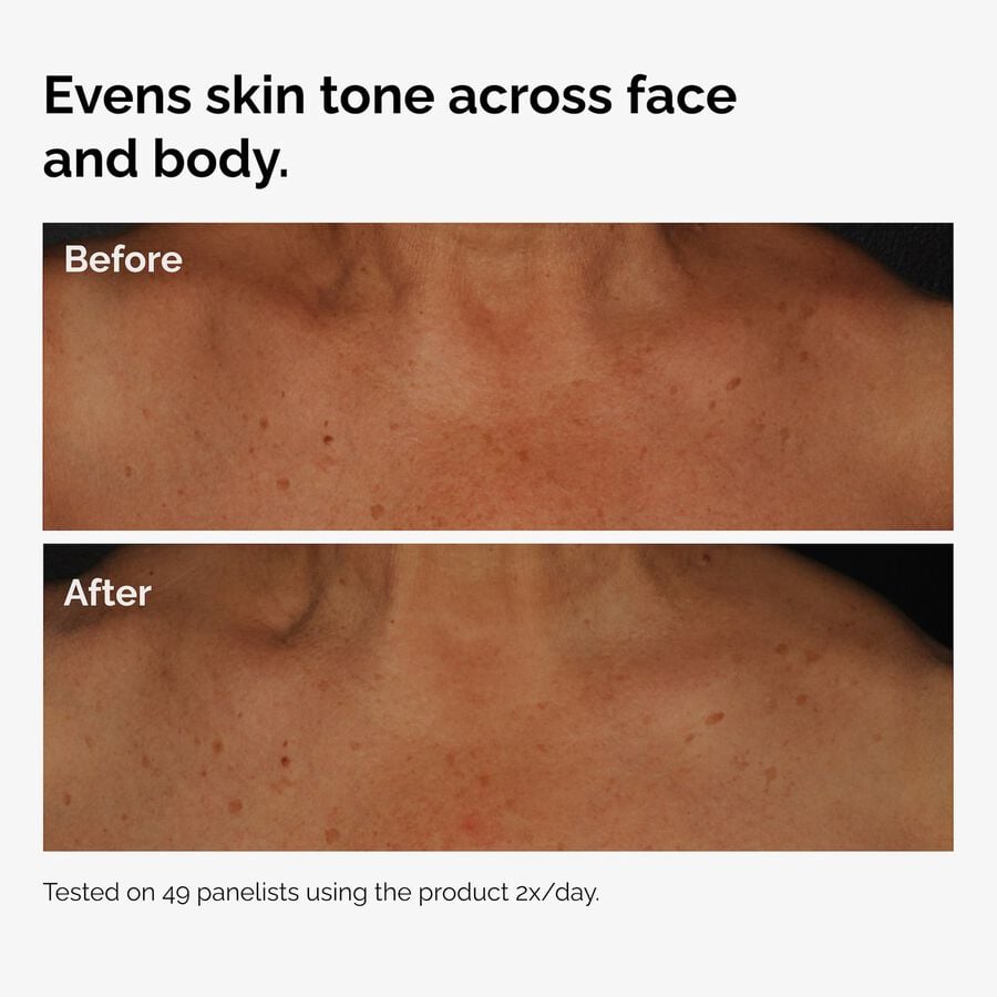 the-body-care-collection-h0 ord-niacinamide-face-body-serum-before-after-even-tone-graphic.jpg